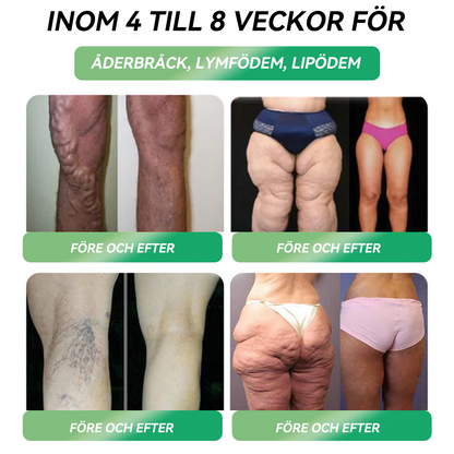 Officiell butik | 𝐇𝐕𝐁®🌟🌟𝐆𝐋𝐏-𝟏 SIX-IN-ONE Hälsolösning Oral Vätska (En dos varje dag – synliga resultat på bara 7 dagar) ⚡ För fetma, hjärt-kärlhälsa, diabetes, sömnapné, ledproblem och mer