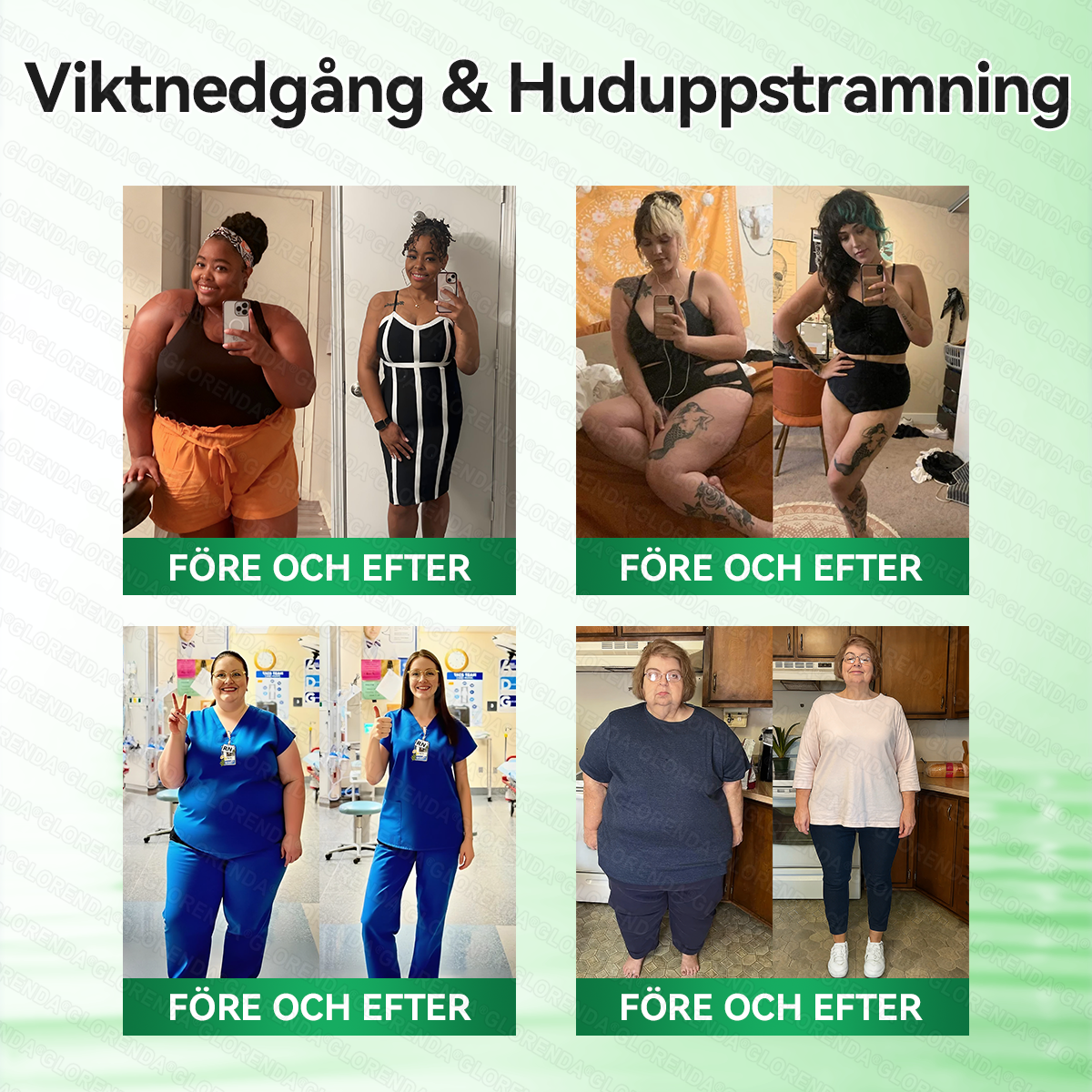 🇸🇪𝐊𝐯𝐚𝐥𝐢𝐭𝐞𝐭𝐬𝐭𝐞𝐬𝐭𝐚𝐝 & 𝐕𝐞𝐫𝐢𝐟𝐢𝐞𝐫𝐚𝐝 🍀💚 𝐆𝐋𝗢𝗥𝗘𝗡𝗗𝑨®𝗕𝗲𝙧𝙗𝐞𝒓𝒊𝒏𝙚 𝙈𝙪𝗹𝘁𝒊-𝑷𝐚𝐭𝐡𝒘𝒂𝙮 𝙈𝙚𝙩𝒂𝒃𝐨𝐥𝙞𝙘 𝙋𝙖𝘁𝗰𝒉 (𝐍𝐚𝐝𝐚 𝐚𝐝𝐡𝐞𝐭 𝐝𝐚𝐠𝐞𝐧, 𝐯𝐢𝐬𝐢𝐛𝐥𝐞 𝐡𝐨̈𝐫𝐧𝐢𝒏𝐠𝒂𝒓 𝐢𝒏𝒏𝒐𝒌 𝟕 𝐝𝐚𝒈𝒆𝒓) ✅ 𝐅𝐨𝐫 𝐨𝐛𝐞𝐬𝐢𝐭𝐲, 🅛🅞🅞🅢🅔 🅢🅚🅘🅝, 𝐝𝐢𝐚𝐛𝐞𝐭𝐞𝐬, 𝐬𝐥𝐞𝐞𝐩 𝐚𝐩𝐧𝐞𝐚, 𝐣𝐨𝐢𝐧𝐭 𝐢𝐬𝐬𝐮𝐞𝐬, 𝐚𝐧𝐝 𝐦𝐨𝐫𝐞